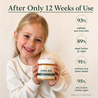 Mella Skin Eczema Cream